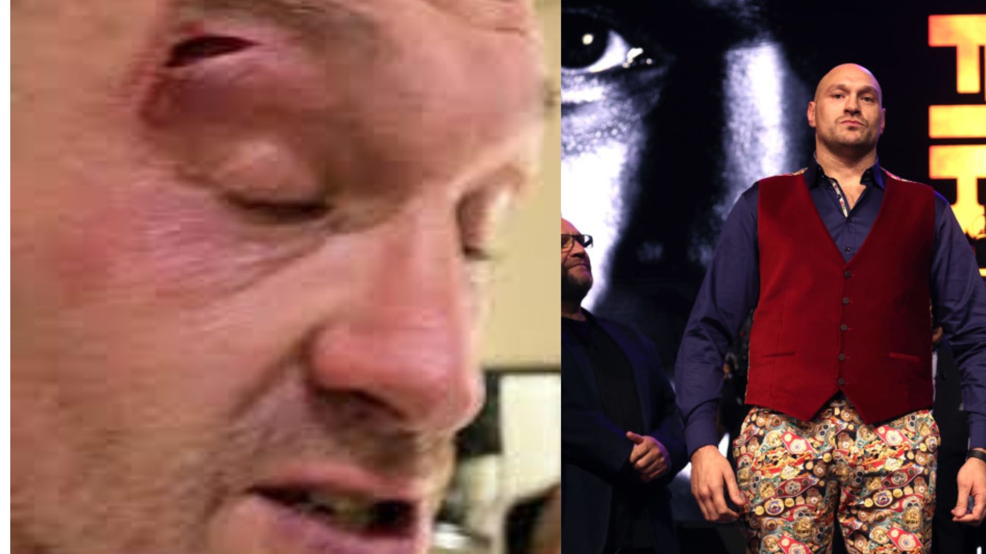 You are currently viewing Tyson Fury leaves the Oleksandr Usyk fight due to injury; he sustained a cut during practice.